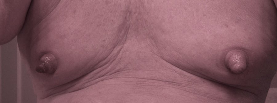 My Nipples